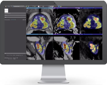 FOR IMMEDIATE RELEASE Bot Image, an Omaha-based MRI medical device company has developed an AI-driven medical device CAD software to...